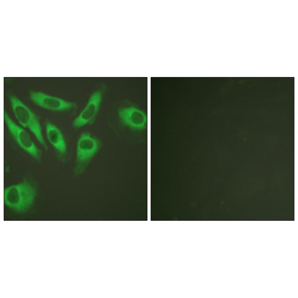Ribosomal Protein S6 Rabbit Polyclonal Antibody | 兔多抗 | EnkiLife恩玑生命