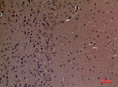 SHIP-2 Rabbit Polyclonal Antibody | 兔多抗 | EnkiLife恩玑生命