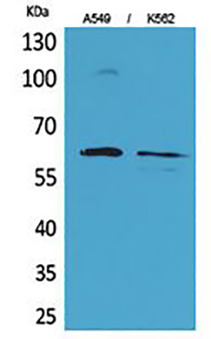 Smad1 Rabbit Polyclonal Antibody | 兔多抗 | EnkiLife恩玑生命