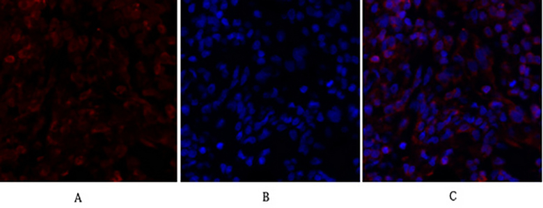 Smad4 Rabbit Polyclonal Antibody | 兔多抗 | EnkiLife恩玑生命