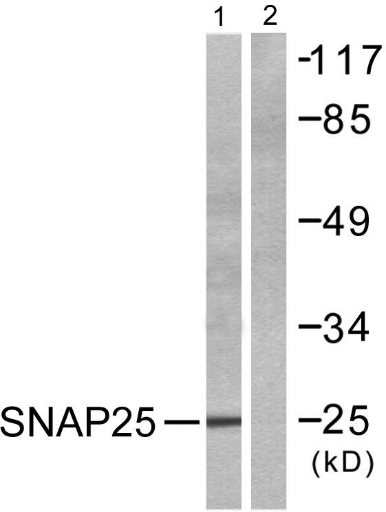 SNAP 25 Rabbit Polyclonal Antibody | 兔多抗 | EnkiLife恩玑生命