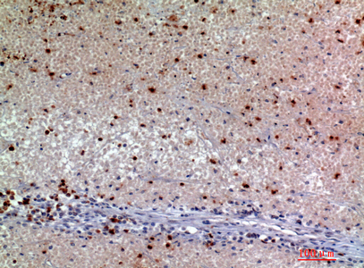 Synuclein-α Rabbit Polyclonal Antibody | 兔多抗 | EnkiLife恩玑生命