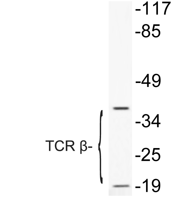 TCR β Rabbit Polyclonal Antibody | 兔多抗 | EnkiLife恩玑生命