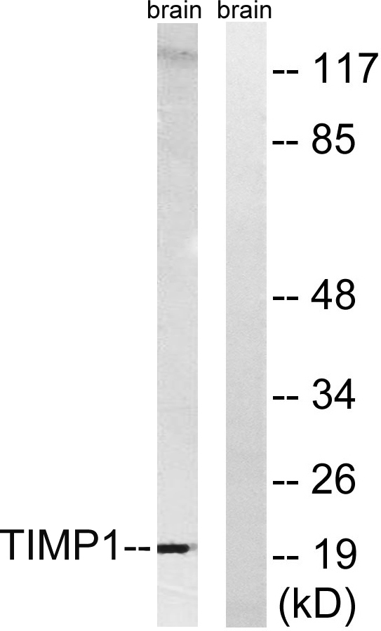 TIMP-1 Rabbit Polyclonal Antibody | 兔多抗 | EnkiLife恩玑生命