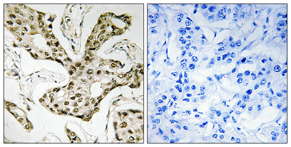Topo IIα Rabbit Polyclonal Antibody | 兔多抗 | EnkiLife恩玑生命