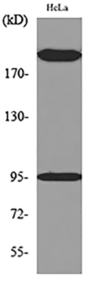 Trk C Rabbit Polyclonal Antibody | 兔多抗 | EnkiLife恩玑生命