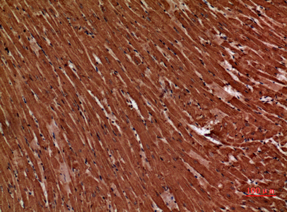 Troponin T-C Rabbit Polyclonal Antibody | 兔多抗 | EnkiLife恩玑生命