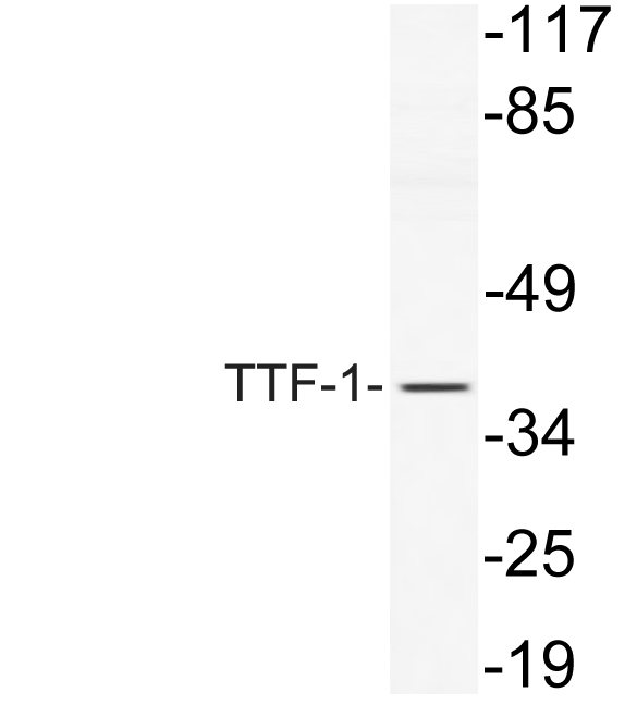 TTF-1 Rabbit Polyclonal Antibody | 兔多抗 | EnkiLife恩玑生命