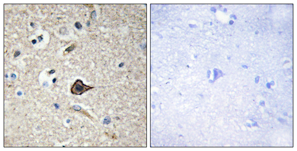 TWEAK Rabbit Polyclonal Antibody | 兔多抗 | EnkiLife恩玑生命