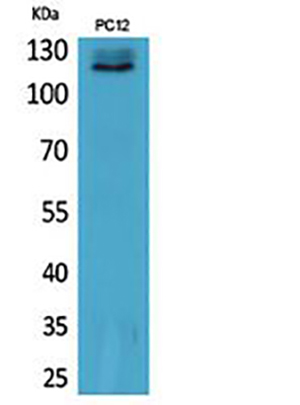 UBA1 Rabbit Polyclonal Antibody | 兔多抗 | EnkiLife恩玑生命