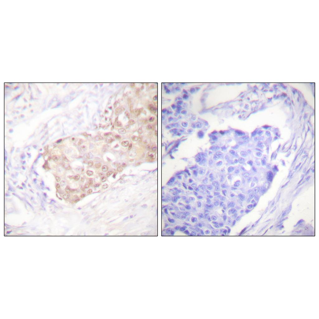 UBR5 Rabbit Polyclonal Antibody | 兔多抗 | EnkiLife恩玑生命