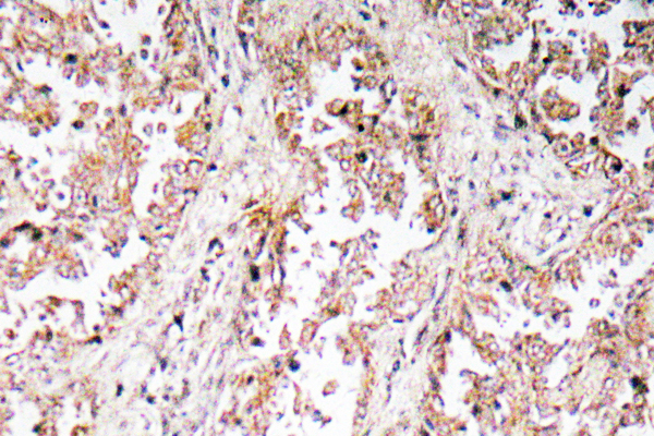 UCP2 Rabbit Polyclonal Antibody | 兔多抗 | EnkiLife恩玑生命
