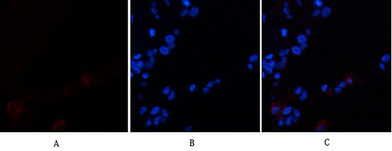 VE-Cadherin Rabbit Polyclonal Antibody | 兔多抗 | EnkiLife恩玑生命