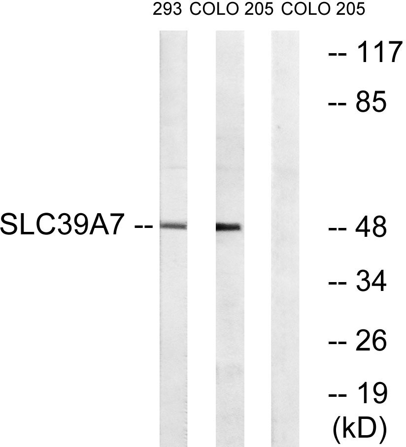 ZIP7 Rabbit Polyclonal Antibody | 兔多抗 | EnkiLife恩玑生命