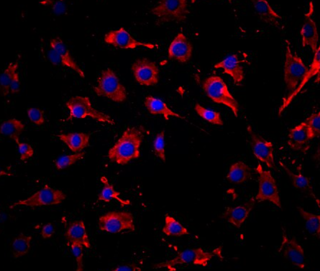 大鼠胰腺外分泌腺肿瘤细胞AR42J