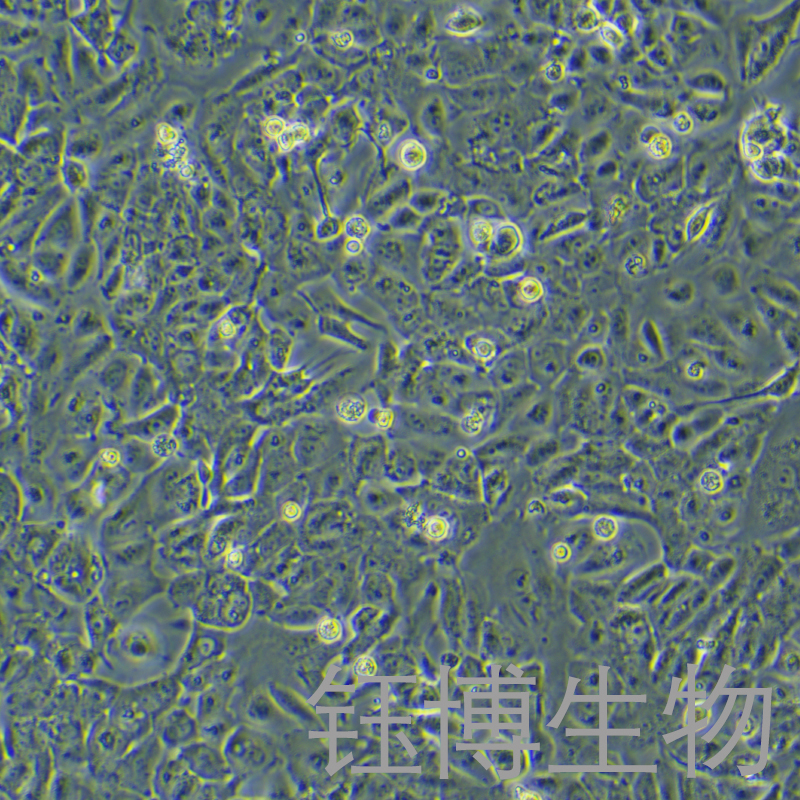 EFO-27（人卵巢腺癌细胞）YB-72052HC