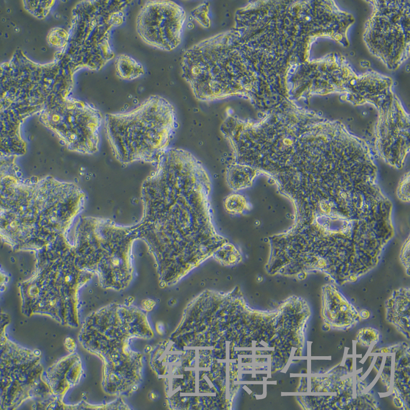 SW1463（人直肠腺癌细胞）YB-72055HC