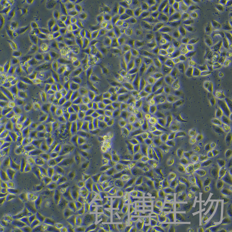 VK2/E6E7（人子宫内膜异位症阴道粘膜上皮细胞）YB-72059HC