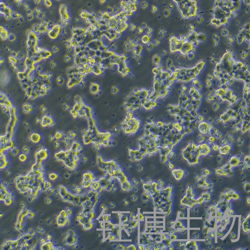 alphaTc1 clone 9（小鼠胰岛细胞腺瘤）YB-75674MC