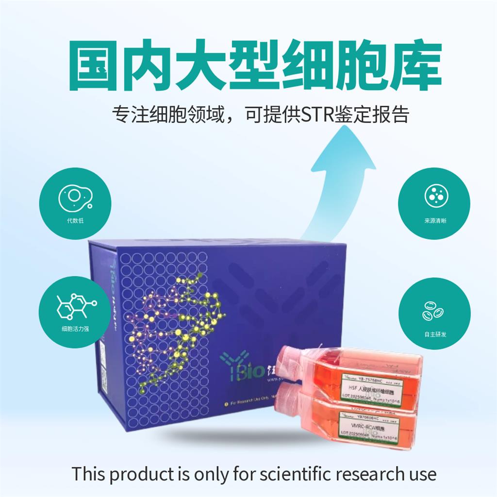 B16-GFP（小鼠黑色素瘤细胞带绿色荧光）YB-72029MC-G
