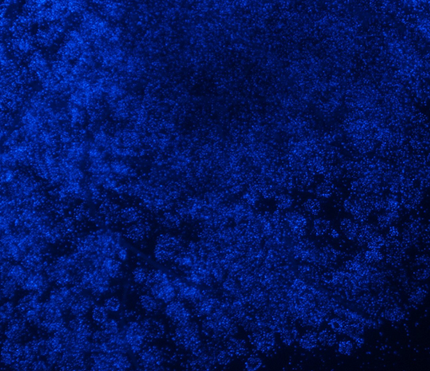 人结直肠腺癌细胞LS174T