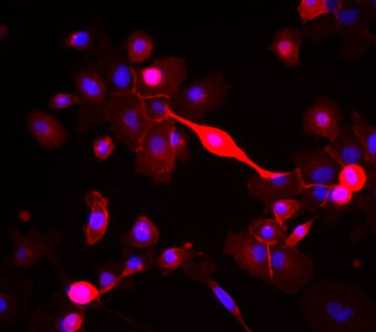 人非小细胞肺癌细胞NCI-H1568 [H1568]