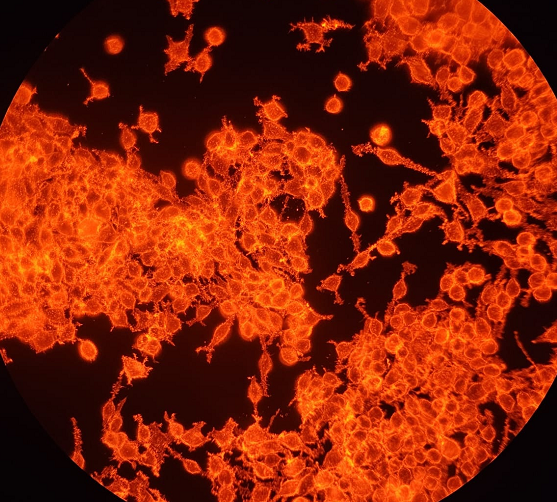 人肺大动脉平滑肌细胞