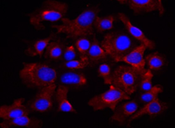 人甲状腺鳞癌细胞SW579