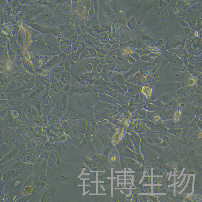 Capan-2-LUC（人胰腺癌细胞（luc标记））YB-75691HC-L