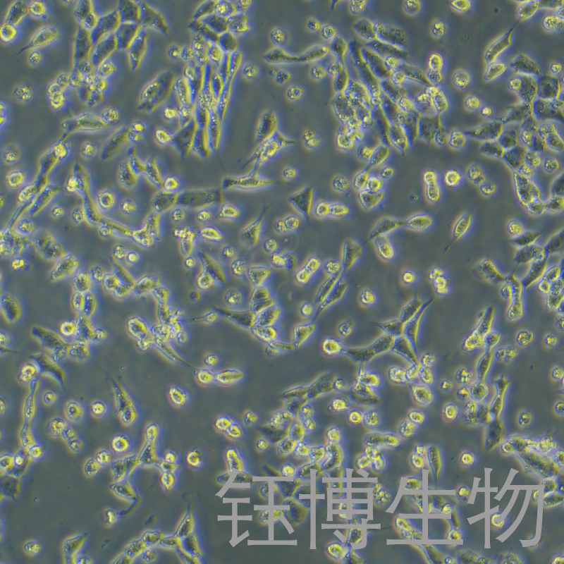 GIST-T1（人胃肠道间质瘤细胞）YB-75720HC