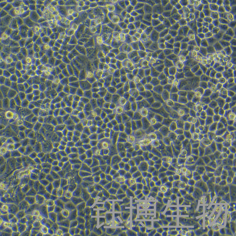 H8（人宫颈上皮永生化细胞）YB-75723HC