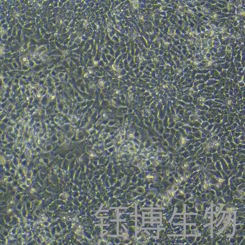 H1（人胚胎干细胞）YB-75722HC