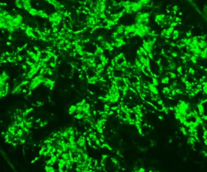 人胚胎眼巩膜成纤维细胞系HFSF
