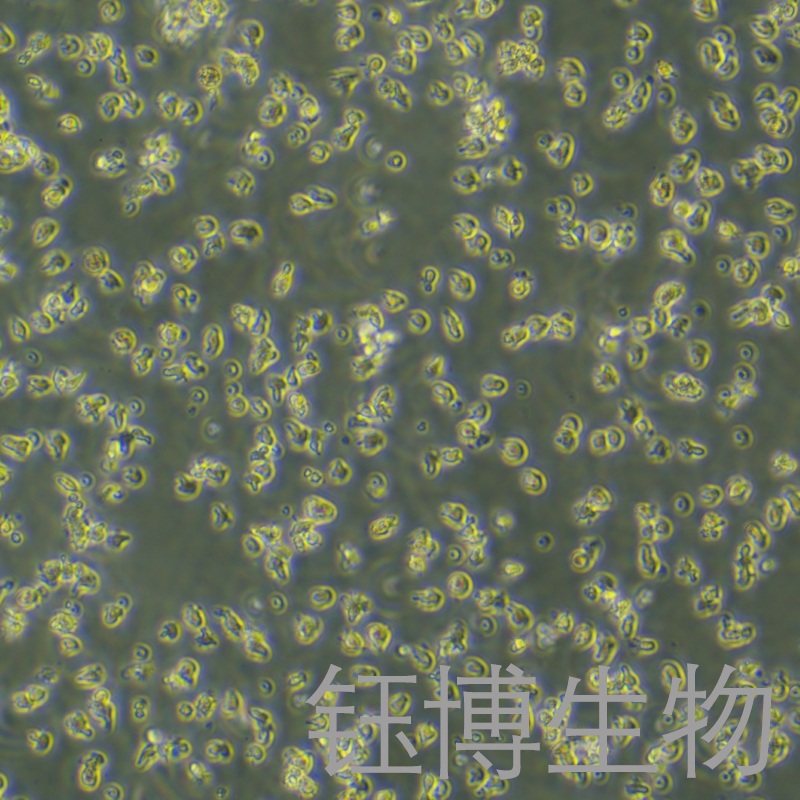 HKBML（淋巴瘤细胞）YB-75750HC