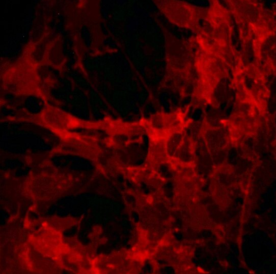 人前列腺平滑肌细胞