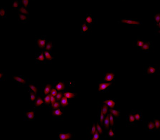 RKO 人结肠腺癌细胞