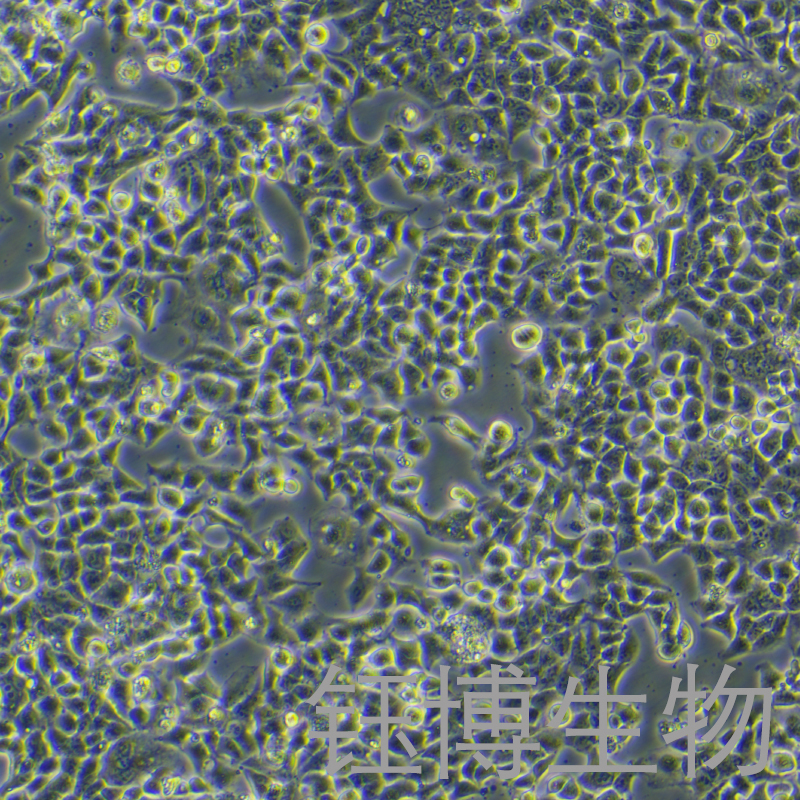 KYSE-70（人食管鳞癌细胞）YB-75788HC