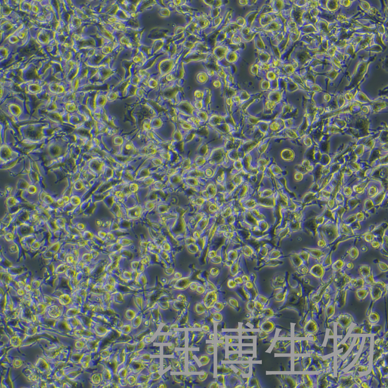 MFC-LUC-GFP-Puro（小鼠前胃癌细胞-红色荧光蛋白-荧光素酶标记）YB-72156MC-LGP