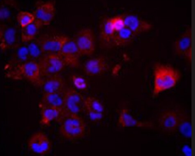 CHO/dhFr- [CHO-DXB11] 仓鼠卵巢细胞二氢叶酸还原酶缺陷