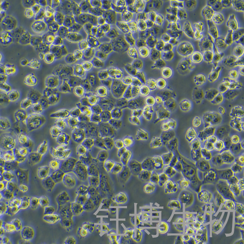 NCI-H1299-GFP(人肺癌细胞(包括非小细胞肺癌)(GFP标记))YB-71165HC-G