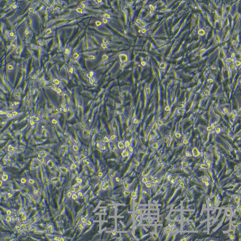 OCM1A（人眼脉络黑色素瘤细胞）YB-75846HC