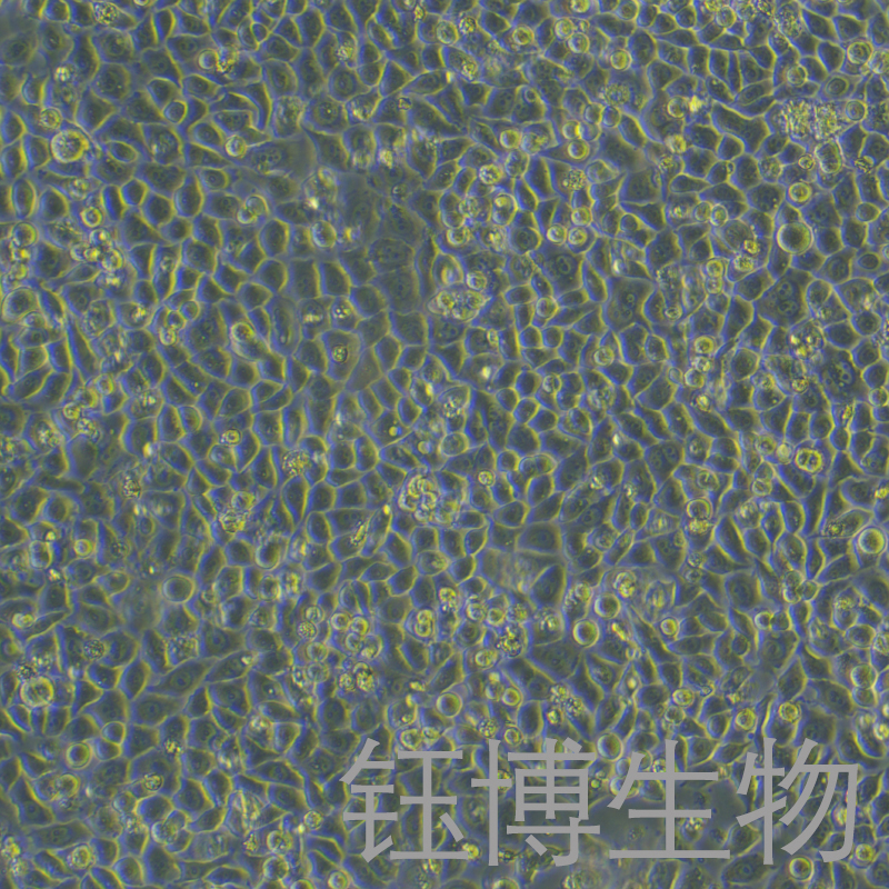 PC-9-LUC-GFP(人肺腺癌细胞带荧光素酶)YB-71668HC-LG