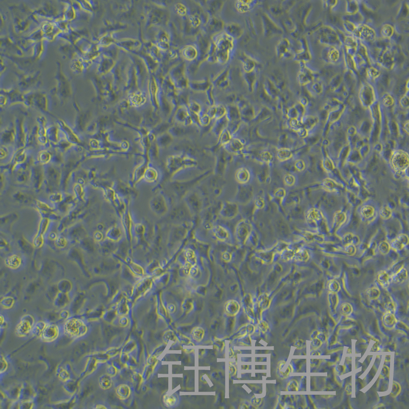 RD-ES（人尤文氏肉瘤）YB-75865HC