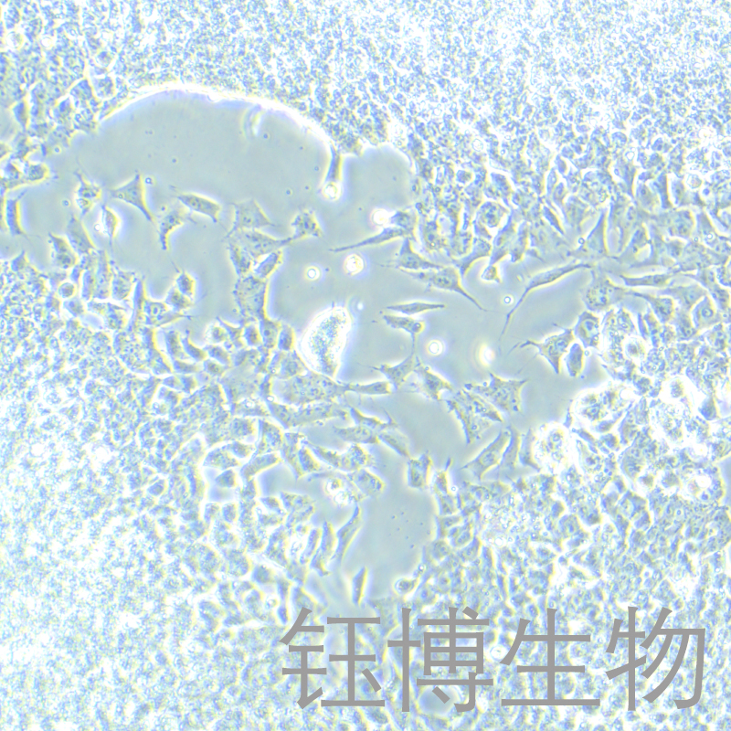 SK-ES-1（尤因肉瘤）YB-75874HC