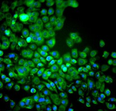 人角膜内皮细胞