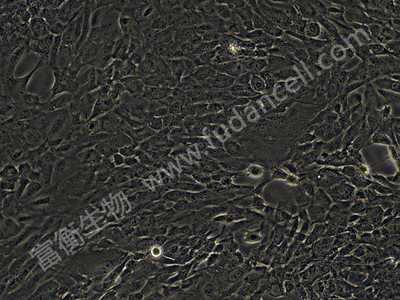 BEAS-2B ;人支气管上皮细胞(STR)