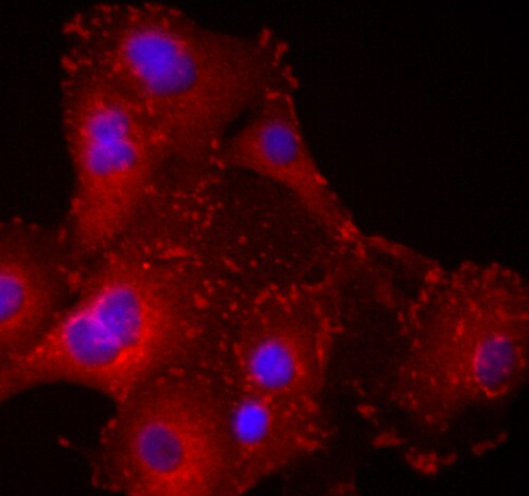 HCC70 人乳腺导管癌细胞