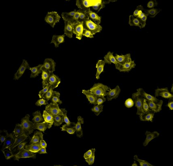 兔退行性椎间盘髓核细胞