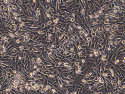 人乳腺癌细胞；MDA-MB-231 (STR)
