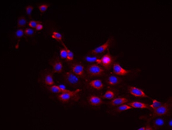 COLO 320HSR人结直肠腺癌细胞